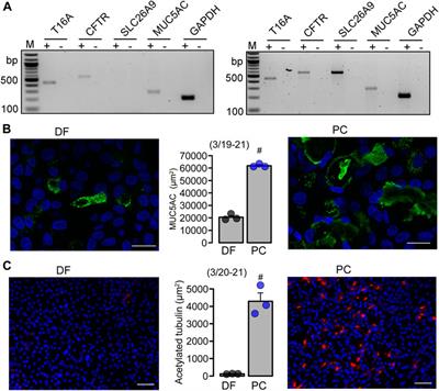 TMEM16A/F support exocytosis but do not inhibit Notch-mediated goblet cell metaplasia of BCi-NS1.1 human airway epithelium